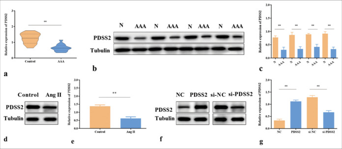 Prenyl diphosphate synthase subunit 2 is downregulated in abdominal aortic aneurysm and retards the progression of abdominal aortic aneurysm.
