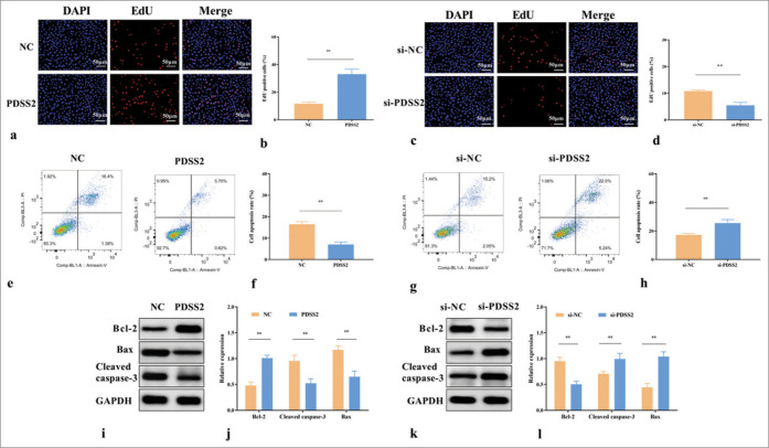 Prenyl diphosphate synthase subunit 2 is downregulated in abdominal aortic aneurysm and retards the progression of abdominal aortic aneurysm.