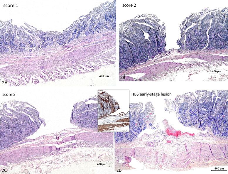 Characterization of early-stage lesions and investigation on the role of mucosal trauma in hemorrhagic bowel syndrome in cattle.