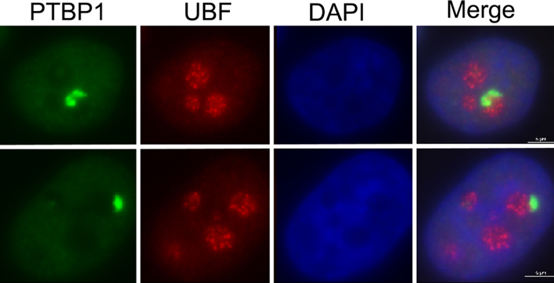 The perinucleolar compartment: structure, function, and utility in anti-cancer drug development.