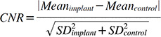 Effect of a metal artifact reduction algorithm on cone-beam computed tomography scans of titanium and zirconia implants within and outside the field of view.