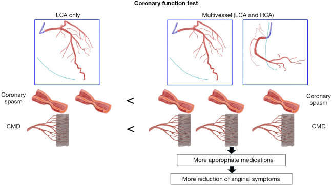 Let us pay more attention to performing coronary function assessment for multivessels!