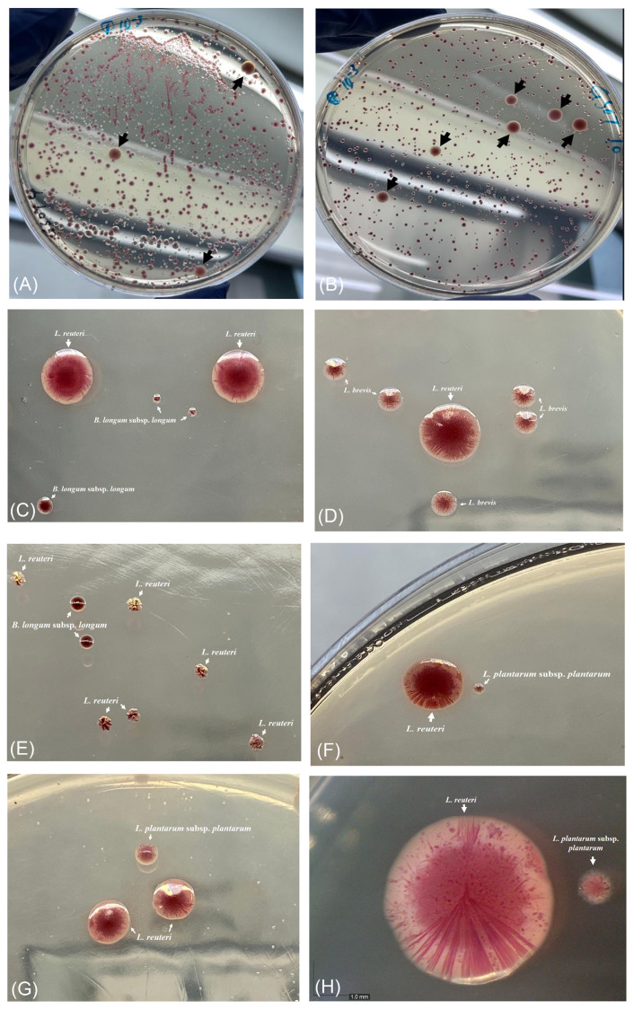 A novel selective medium for isolation of Limosilactobacillus reuteri from dietary supplements.