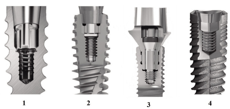 Evaluating the microgap and sealing capability in four implant systems with different interlockings under different tightening torques: an <i>in-vitro</i> study.