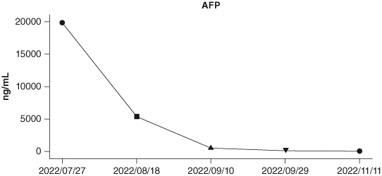 Cytokine release syndrome caused by immune checkpoint inhibitors: a case report and literature review.