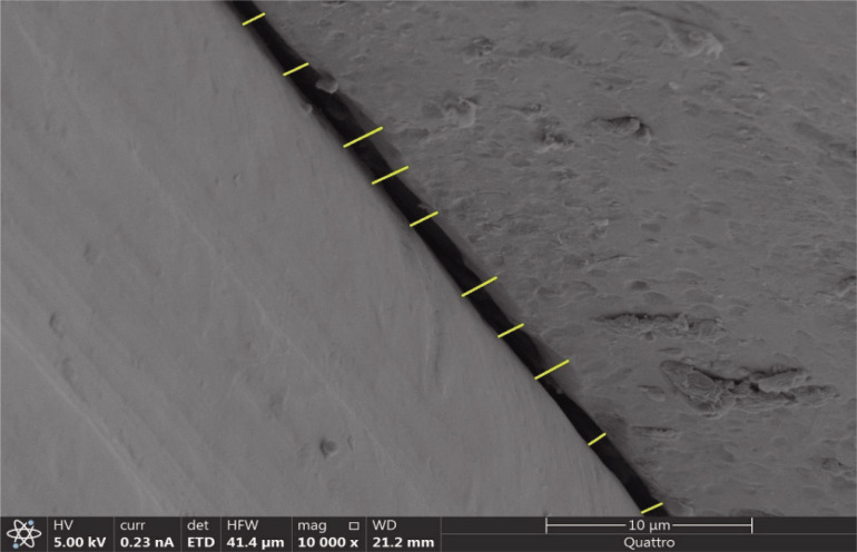 Evaluating the microgap and sealing capability in four implant systems with different interlockings under different tightening torques: an <i>in-vitro</i> study.