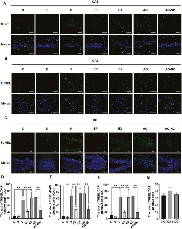 17β-Estradiol Ameliorates Postoperative Cognitive Dysfunction in Aged Mice via miR-138-5p/SIRT1/HMGB1 Pathway.