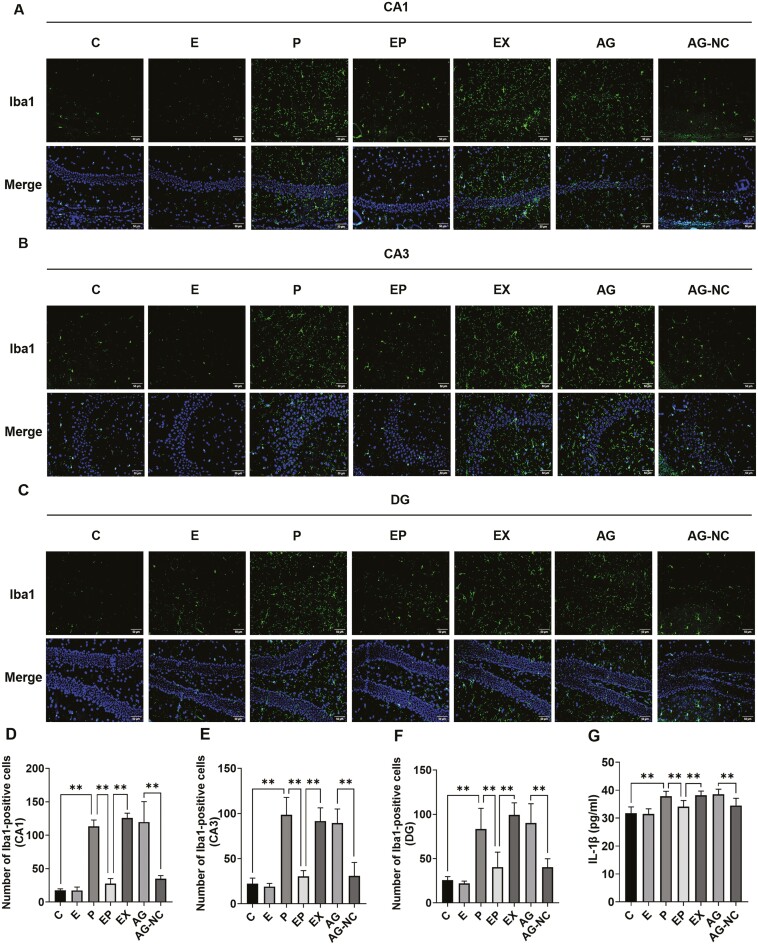 17β-Estradiol Ameliorates Postoperative Cognitive Dysfunction in Aged Mice via miR-138-5p/SIRT1/HMGB1 Pathway.