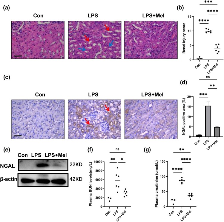 Melittin alleviates sepsis-induced acute kidney injury by promoting GPX4 expression to inhibit ferroptosis.