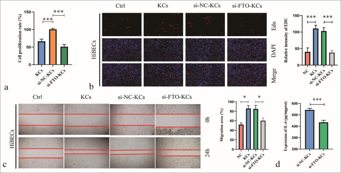 FTO-mediated regulation of Kupffer cell polarization and interleukin-6 secretion promotes biliary epithelial cell proliferation in intrahepatic bile duct stones.
