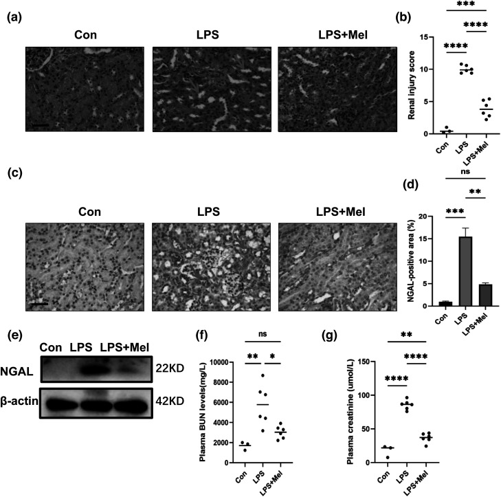 Melittin alleviates sepsis-induced acute kidney injury by promoting GPX4 expression to inhibit ferroptosis.