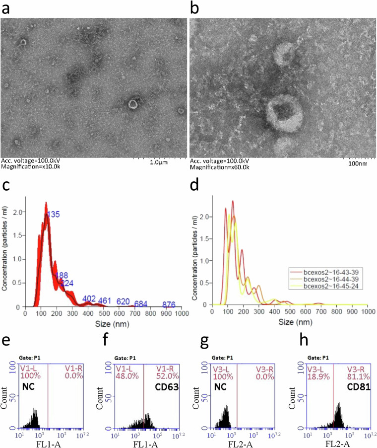 Small RNA sequencing data of plasma extracellular vesicles in a breast cancer screening population.