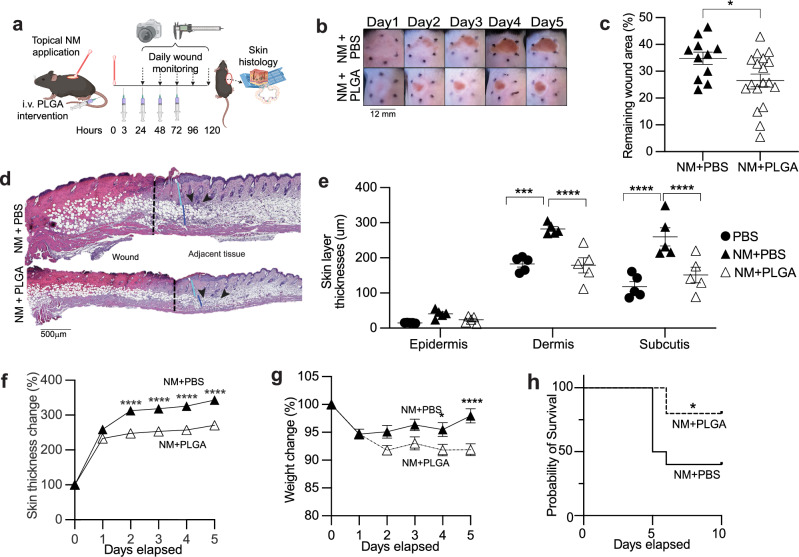 Attenuation of skin injury by a MARCO targeting PLGA nanoparticle.