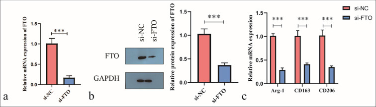 FTO-mediated regulation of Kupffer cell polarization and interleukin-6 secretion promotes biliary epithelial cell proliferation in intrahepatic bile duct stones.