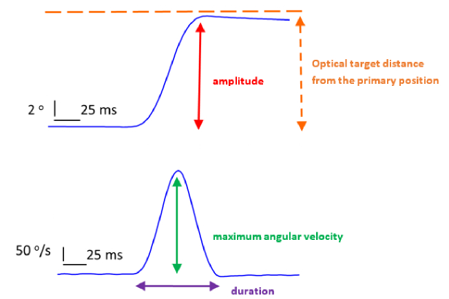 Saccade Dynamics in the Acute and Recovery Phase of Abducens Nerve Palsy.