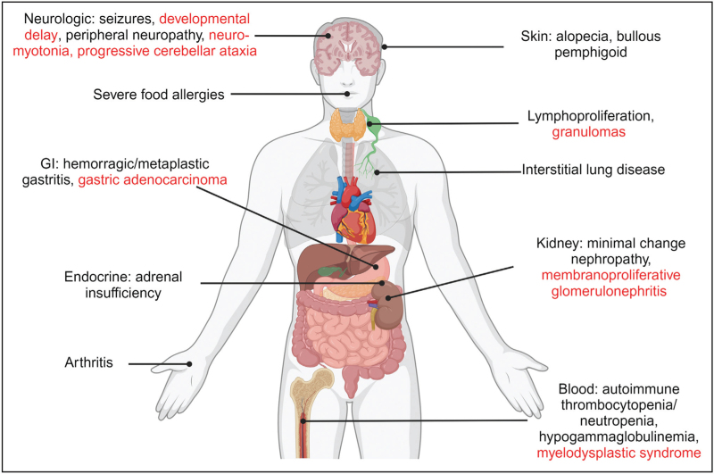Expanding the spectrum of IPEX: from new clinical findings to novel treatments.