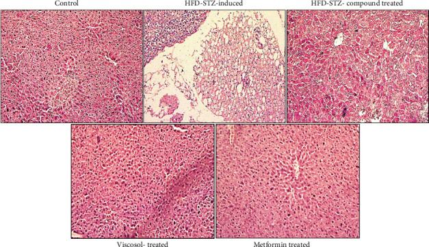 Viscosol Treatment Ameliorates Insulin-Mediated Regulation of Dyslipidemia, Hepatic Steatosis, and Lipid Metabolism by Targeting PTP1B in Type-2 Diabetic Mice Model.