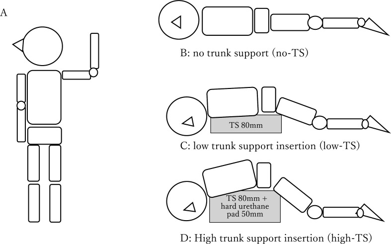 Interventional study of the effect of trunk support provision on the body pressure and ventilation volume in the prone position in healthy young and older women.