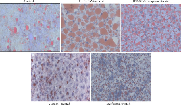 Viscosol Treatment Ameliorates Insulin-Mediated Regulation of Dyslipidemia, Hepatic Steatosis, and Lipid Metabolism by Targeting PTP1B in Type-2 Diabetic Mice Model.