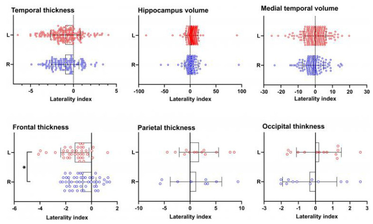 Lateralizing Value of Artificial Intelligence-Based Segmentation Software in MRI-Negative Focal Epilepsy.