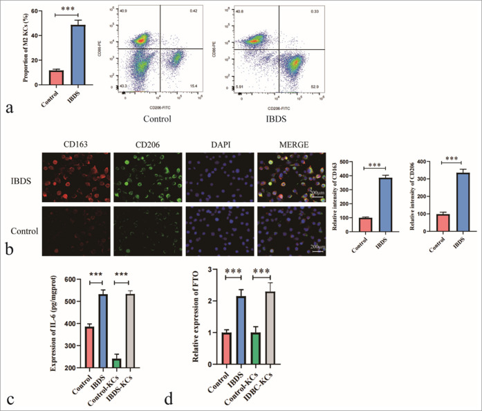 FTO-mediated regulation of Kupffer cell polarization and interleukin-6 secretion promotes biliary epithelial cell proliferation in intrahepatic bile duct stones.