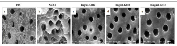 Efficacy of Antimicrobial Peptide GH12 on a Multispecies Endodontic Biofilm Model: An In-vitro Study.