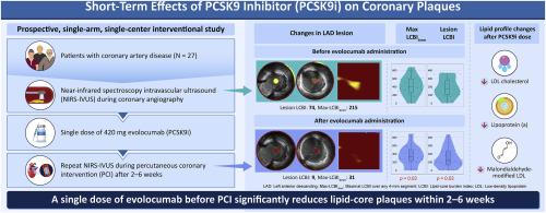 Very short-term effects of a single dose of a proprotein convertase subtilisin/kexin 9 inhibitor before percutaneous coronary intervention: A single-arm study