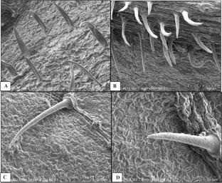 Exploring the phytoremediation potential of Toona ciliata grown on lead and cadmium contaminated soils through morphological and anatomical analysis