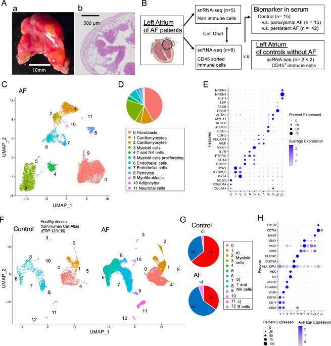 Left atrial single-cell transcriptomics reveals amphiregulin as a surrogate marker for atrial fibrillation