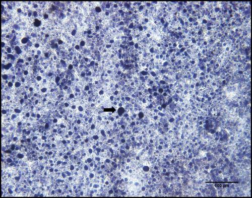 Liver Structure and Function in Yellowtail Kingfish, Seriola lalandi, in Response to Reduced Fish Meal Diets