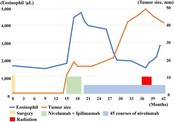 Usage of nivolumab and ipilimumab for recurrent or advanced malignant vaginal melanoma: a two-case series.