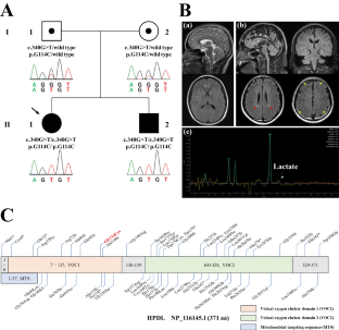 A novel homozygous HPDL variant in Japanese siblings with autosomal recessive hereditary spastic paraplegia: case report and literature review.