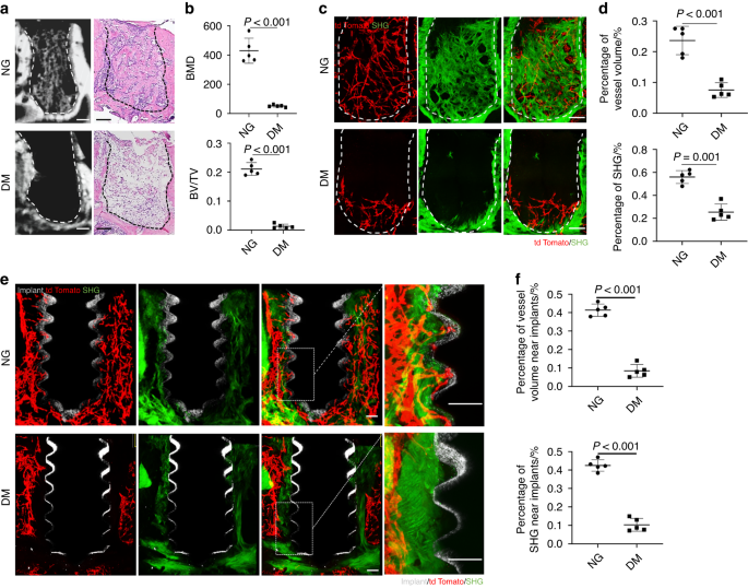 Magnesium promotes vascularization and osseointegration in diabetic states