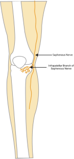 Infrapatellar Branch of the Saphenous Nerve: Therapeutic Approaches to Chronic Knee Pain.