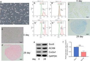 Suppression of MALAT1 promotes human synovial mesenchymal stem cells enhance chondrogenic differentiation and prevent osteoarthritis of the knee in a rat model via regulating miR-212-5p/MyD88 axis.