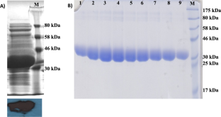 Biochemical and in silico structural characterization of a cold-active arginase from the psychrophilic yeast, Glaciozyma antarctica PI12.