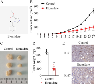 Etomidate inhibits tumor growth of glioblastoma by regulating M1 macrophage polarization.