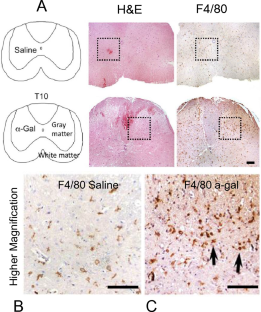 α-Gal Nanoparticles in CNS Trauma: II. Immunomodulation Following Spinal Cord Injury (SCI) Improves Functional Outcomes