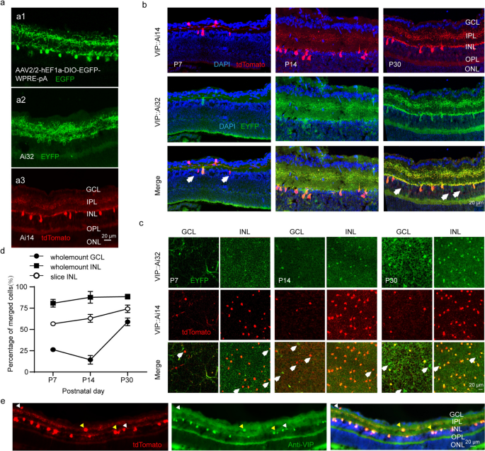 Characterization of Retinal VIP-Amacrine Cell Development During the Critical Period