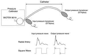 The 10 Hz dynamic response of a fluid-filled pressure monitoring system is a novel alternative to the fast flush test and indicative of unacceptable systolic pressure overshoot.