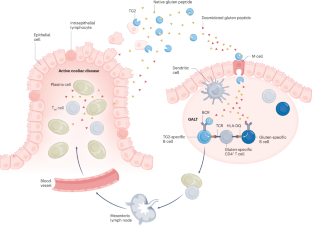 Tolerance-inducing therapies in coeliac disease — mechanisms, progress and future directions