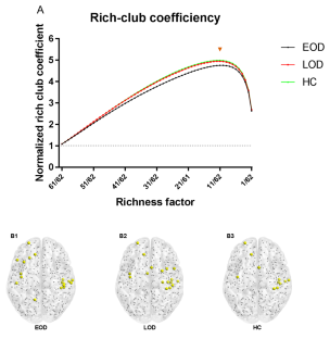 Increasing variance of rich-club nodes distribution in early onset depression according to dynamic network.