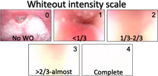 Evaluation of the Whiteout During Fiberoptic Endoscopic Evaluation of Swallowing and Examination of Its Correlation with Pharyngeal Residue and Aspiration.