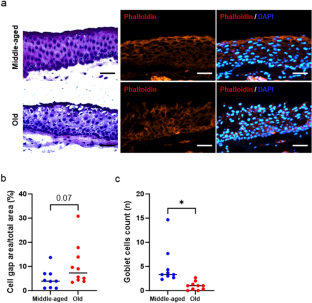 The existence of senescent cells in conjunctival epithelium from elderly individuals.