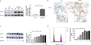 CD137 Signaling Mediates Pulmonary Artery Endothelial Cell Proliferation Under Hypoxia By Regulating Mitochondrial Dynamics.