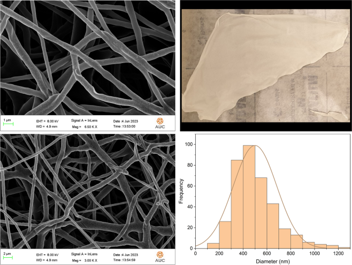 Synergistic anticancer effect of Pistacia lentiscus essential oils and 5-Fluorouracil co-loaded onto biodegradable nanofibers against melanoma and breast cancer.