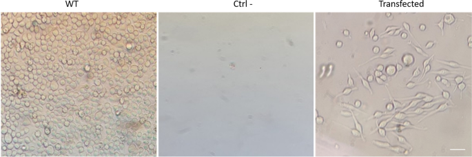 Rapid generation of an RBL cellular model to study proteins that cause allergenic reactions in vitro.