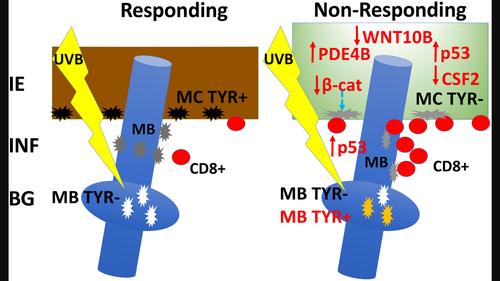 Vitiligo non-responding lesions to narrow band UVB have intriguing cellular and molecular abnormalities that may prevent epidermal repigmentation