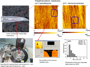 3D porous structure imaging of membranes for medical devices using scanning probe microscopy and electron microscopy: from membrane science points of view.