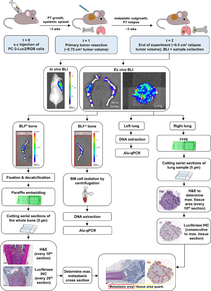 Comparison of ex vivo bioluminescence imaging, Alu-qPCR and histology for the quantification of spontaneous lung and bone metastases in subcutaneous xenograft mouse models.